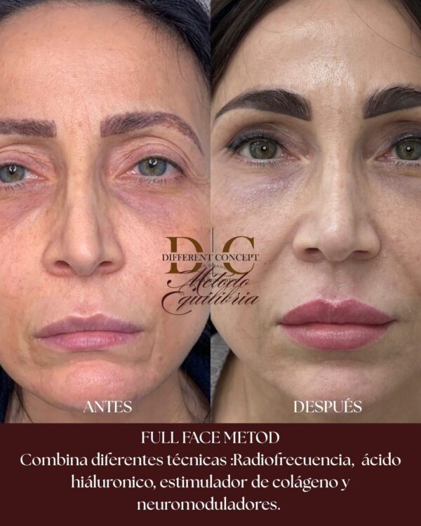 FULL FACE - Imagen 3